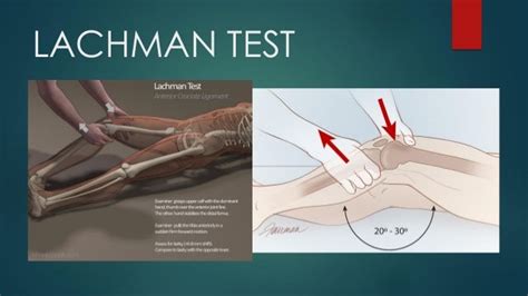 mcmurray test vs lachman